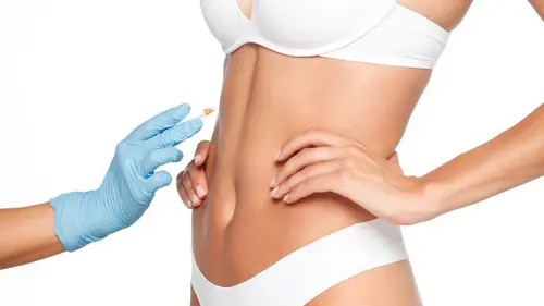 plastiline kirurgia pärast kardinaid